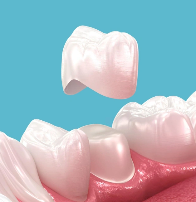 dental crown lengthening