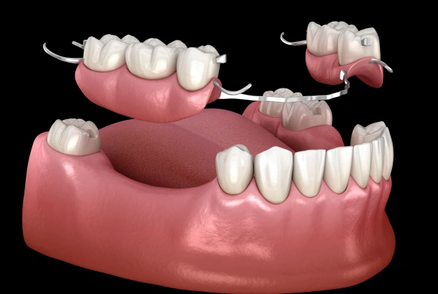 dentures and bridges in erdenheim