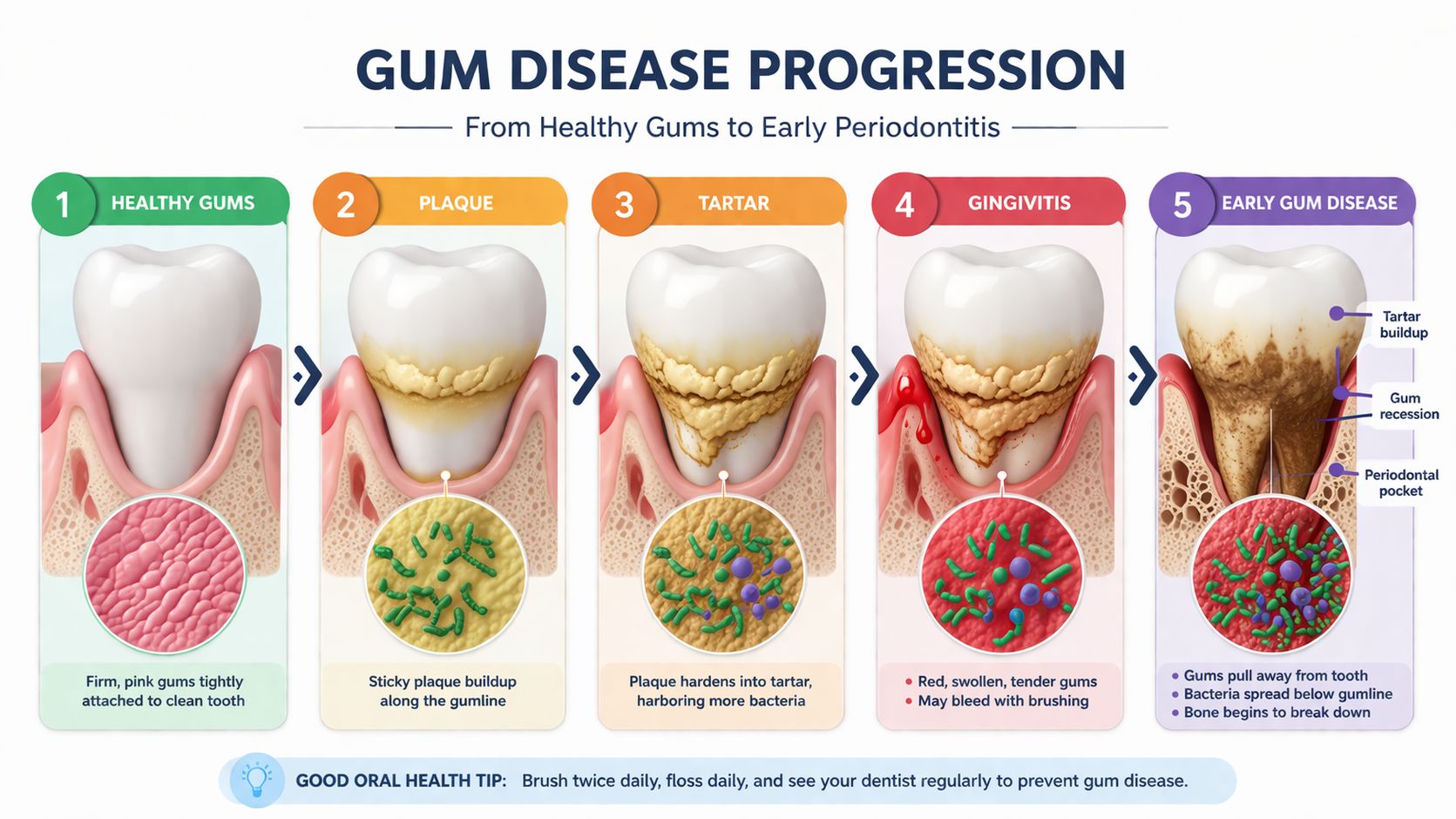 gum disease progression