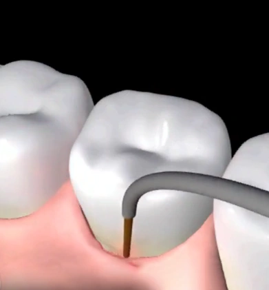 Modern dental care at The Schiff & Moniz Dental Group